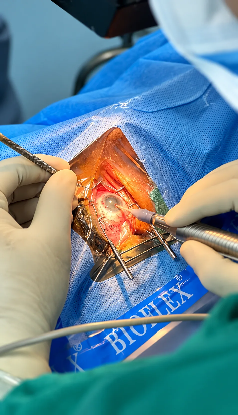 Retina & Uvea